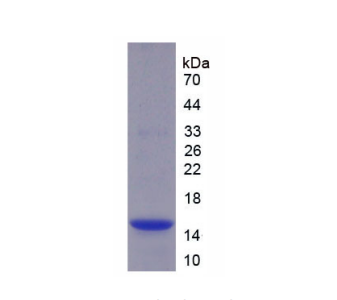 半胱氨酸蛋白酶抑制劑4(CST4)重組蛋白,Recombinant Cystatin 4 (CST4)