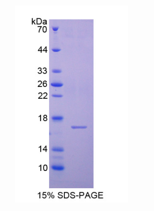 半胱氨酸蛋白酶抑制劑6(CST6)重組蛋白,Recombinant Cystatin 6 (CST6)