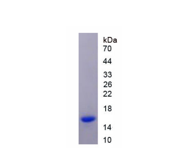 半胱氨酸蛋白酶抑制劑1(CST1)重組蛋白,Recombinant Cystatin 1 (CST1)