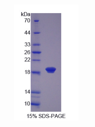 毛状样蛋白1(COTL1)重组蛋白,Recombinant Coactosin Like Protein 1 (COTL1)