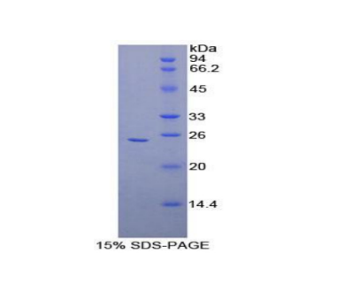 冠蛋白1A(CORO1A)重组蛋白,Recombinant Coronin 1A (CORO1A)