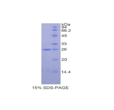 兒茶酚-O-甲基轉(zhuǎn)移酶(COMT)重組蛋白,Recombinant Catechol-O-Methyltransferase (COMT)