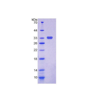 几丁质酶1(CHIT1)重组蛋白,Recombinant Chitinase 1 (CHIT1)