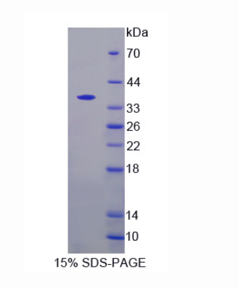 几丁质酶3样蛋白2(CHI3L2)重组蛋白,Recombinant Chitinase 3 Like Protein 2 (CHI3L2)