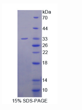 鈣調(diào)寧蛋白2(CNN2)重組蛋白,Recombinant Calponin 2 (CNN2)