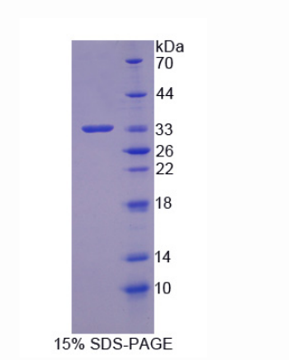 鈣調(diào)寧蛋白1(CNN1)重組蛋白,Recombinant Calponin 1, Basic (CNN1)