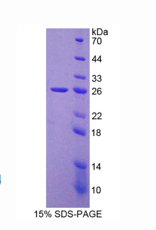 染色质装配因子1亚基B(CHAF1B)重组蛋白,Recombinant Chromatin Assembly Factor 1, Subunit B (CHAF1B)