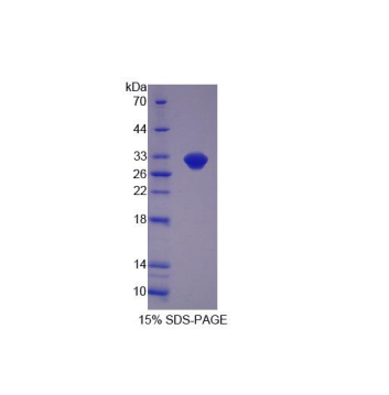 內(nèi)酰胺酶β(LACTb)重組蛋白,Recombinant Lactamase Beta (LACTb)