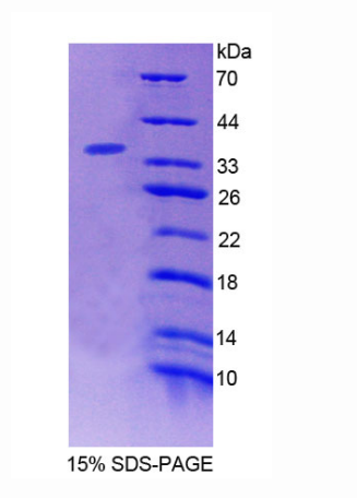 橋連整合因子2(BIN2)重組蛋白,Recombinant Bridging Integrator 2 (BIN2)