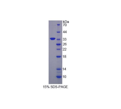 桥连整合因子1(BIN1)重组蛋白,Recombinant Bridging Integrator 1 (BIN1)