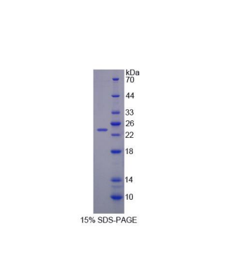 支链α-酮酸脱氢酶(BCKDK)重组蛋白,Recombinant Branched Chain Alpha-Ketoacid Dehydrogenase Kinase (BCKDK)