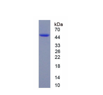 脑富含膜附着信号蛋白1(BASP1)重组蛋白,Recombinant Brain Abundant, Membrane Attached Signal Protein 1 (BASP1)