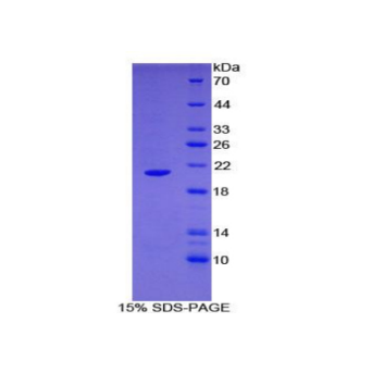 肌动蛋白相关蛋白2/3复合体亚基4(ARPC4)重组蛋白,Recombinant Actin Related Protein 2/3 Complex Subunit 4 (ARPC4)