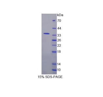 ?；人崴饷?AOAH)重組蛋白,Recombinant Acyloxyacyl Hydrolase (AOAH)