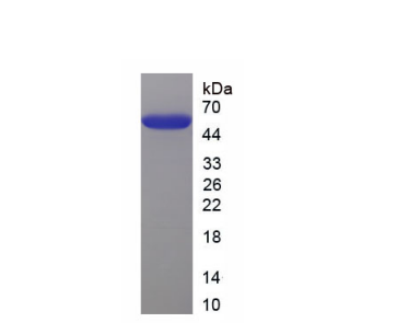 苯胺素(ANLN)重组蛋白,Recombinant Anillin (ANLN)