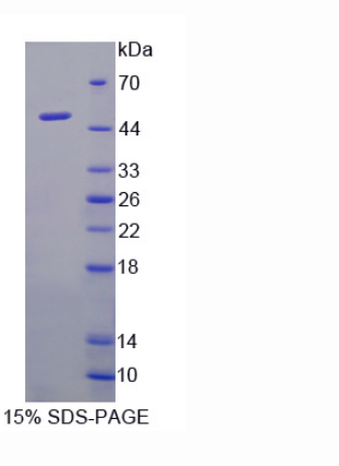 芳烃受体抑制因子(AHRR)重组蛋白,Recombinant Aryl Hydrocarbon Receptor Repressor (AHRR)