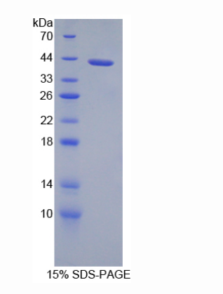 胍基丁胺脲水解酶(AGMAT)重组蛋白,Recombinant Agmatine Ureohydrolase (AGMAT)