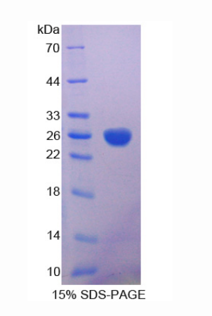 順烏頭酸酶1(ACO1)重組蛋白,Recombinant Aconitase 1 (ACO1)