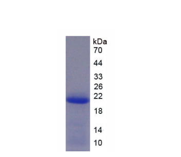 解整合素金屬蛋白酶15(ADAM15)重組蛋白,Recombinant A Disintegrin And Metalloprotease 15 (ADAM15)