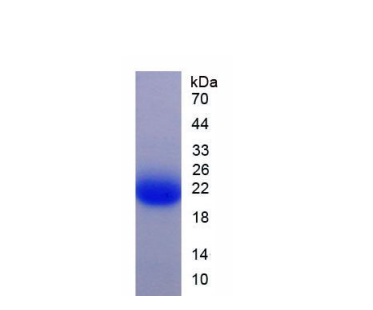 酪氨酸3/色氨酸5单加氧酶激活蛋白ζ(YWHAz)重组蛋白,Recombinant Tyrosine 3/Tryptophan 5 Monooxygenase Activation Protein Zeta (YWHAz)