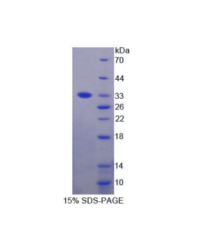 磷酸肌醇-3-激酶催化亚基δ肽(PIK3Cd)重组蛋白,Recombinant Phosphoinositide-3-Kinase Catalytic Delta Polypeptide (PIK3Cd)