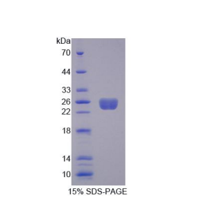 Rho鸟嘌呤核苷酸交换因子7(ARHGEF7)重组蛋白,Recombinant Rho Guanine Nucleotide Exchange Factor 7 (ARHGEF7)
