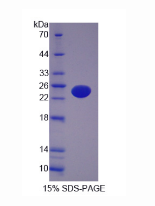 AF4/FMR2家族成员1(AFF1)重组蛋白,Recombinant AF4/FMR2 Family, Member 1 (AFF1)