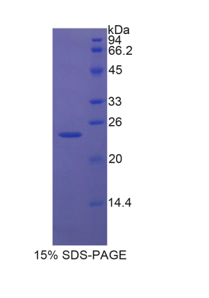 齿状片段同源框蛋白2(EN2)重组蛋白,Recombinant Engrailed Homeobox Protein 2 (EN2)