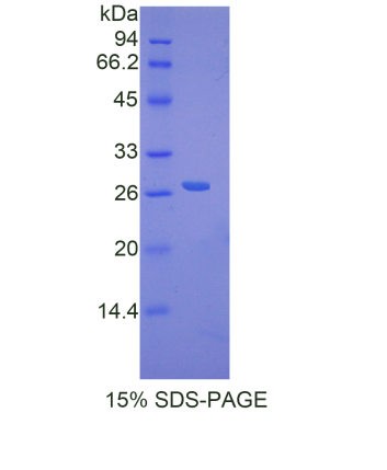 DNA修复蛋白RAD50(RAD50)重组蛋白,Recombinant DNA Repair Protein RAD50 (RAD50)