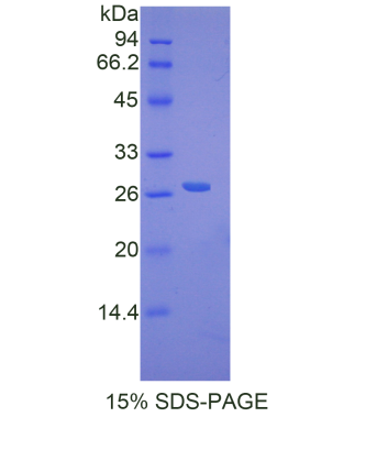 DNA修復(fù)蛋白RAD50(RAD50)重組蛋白,Recombinant DNA Repair Protein RAD50 (RAD50)