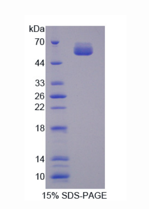 L-苏氨酸脱氢酶(TDH)重组蛋白,Recombinant L-Threonine Dehydrogenase (TDH)