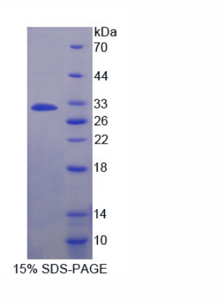 解整合素金属蛋白酶22(ADAM22)重组蛋白,Recombinant A Disintegrin And Metalloprotease 22 (ADAM22)