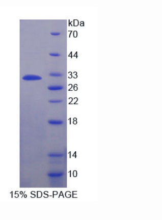 解整合素金屬蛋白酶22(ADAM22)重組蛋白,Recombinant A Disintegrin And Metalloprotease 22 (ADAM22)