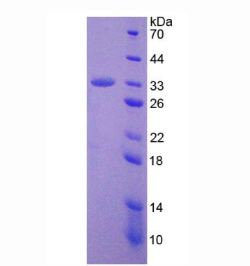 解整合素金屬蛋白酶28(ADAM28)重組蛋白,Recombinant A Disintegrin And Metalloprotease 28 (ADAM28)