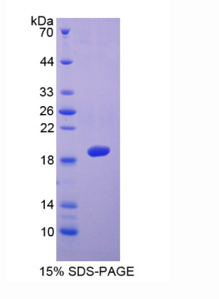 血小板反應蛋白解整合素金屬肽酶5(ADAMTS5)重組蛋白,Recombinant A Disintegrin And Metalloproteinase With Thrombospondin 5 (ADAMTS5)