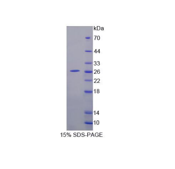 血小板反应蛋白解整合素金属肽酶9(ADAMTS9)重组蛋白,Recombinant A Disintegrin And Metalloproteinase With Thrombospondin 9 (ADAMTS9)
