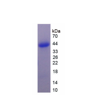 Nodal同源物(NODAL)重组蛋白,Recombinant Nodal Homolog (NODAL)