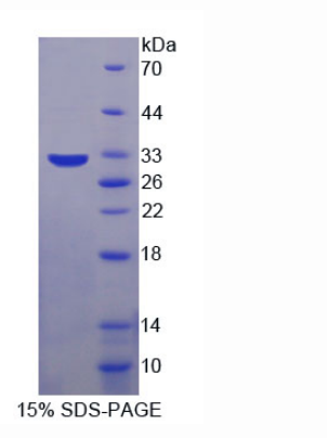 DNA激活蛋白激酶催化亚基肽(PRKDC)重组蛋白,Recombinant Protein Kinase, DNA Activated, Catalytic Polypeptide (PRKDC)