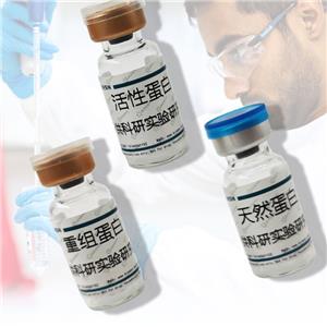 半胱氨酸蛋白酶抑制劑2(CST2)重組蛋白,Recombinant Cystatin 2 (CST2)