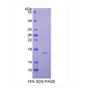 半胱氨酸蛋白酶抑制剂6(CST6)重组蛋白