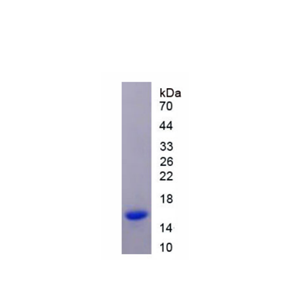 半胱氨酸蛋白酶抑制剂1(CST1)重组蛋白,Recombinant Cystatin 1 (CST1)