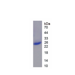 酪蛋白β(CSN2)重组蛋白