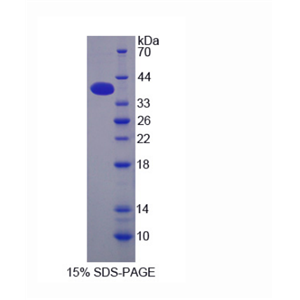 剪切多聚腺苷酸化特异性因子1(CPSF1)重组蛋白