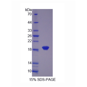 毛状样蛋白1(COTL1)重组蛋白,Recombinant Coactosin Like Protein 1 (COTL1)