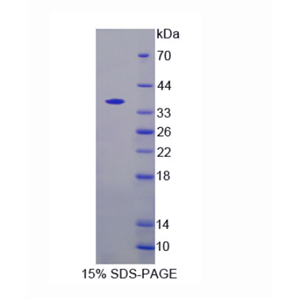 几丁质酶3样蛋白2(CHI3L2)重组蛋白,Recombinant Chitinase 3 Like Protein 2 (CHI3L2)