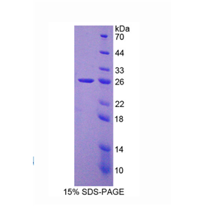 染色质装配因子1亚基B(CHAF1B)重组蛋白,Recombinant Chromatin Assembly Factor 1, Subunit B (CHAF1B)