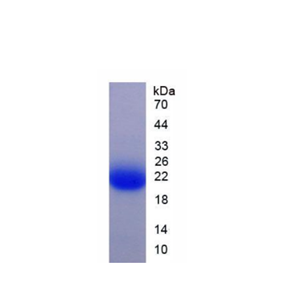 酪氨酸3/色氨酸5单加氧酶激活蛋白ζ(YWHAz)重组蛋白,Recombinant Tyrosine 3/Tryptophan 5 Monooxygenase Activation Protein Zeta (YWHAz)