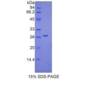 DNA修复蛋白RAD50(RAD50)重组蛋白,Recombinant DNA Repair Protein RAD50 (RAD50)
