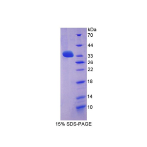 亮氨酸丰富重复LGI家族成员3(LGI3)重组蛋白