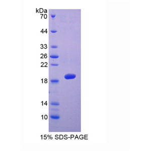 血小板反应蛋白解整合素金属肽酶5(ADAMTS5)重组蛋白